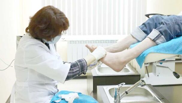 Un dermatólogo trata los hongos en las uñas de los pies. 