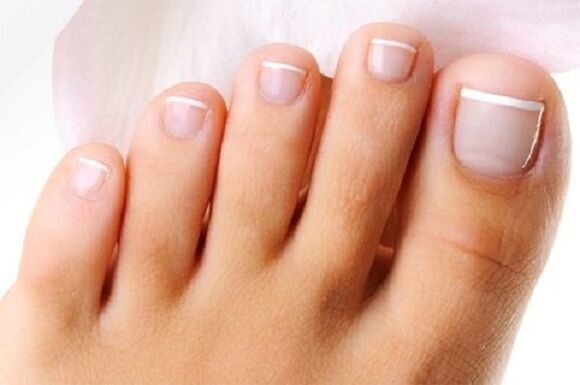 clavos