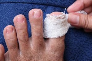 compresa para hongos en las uñas